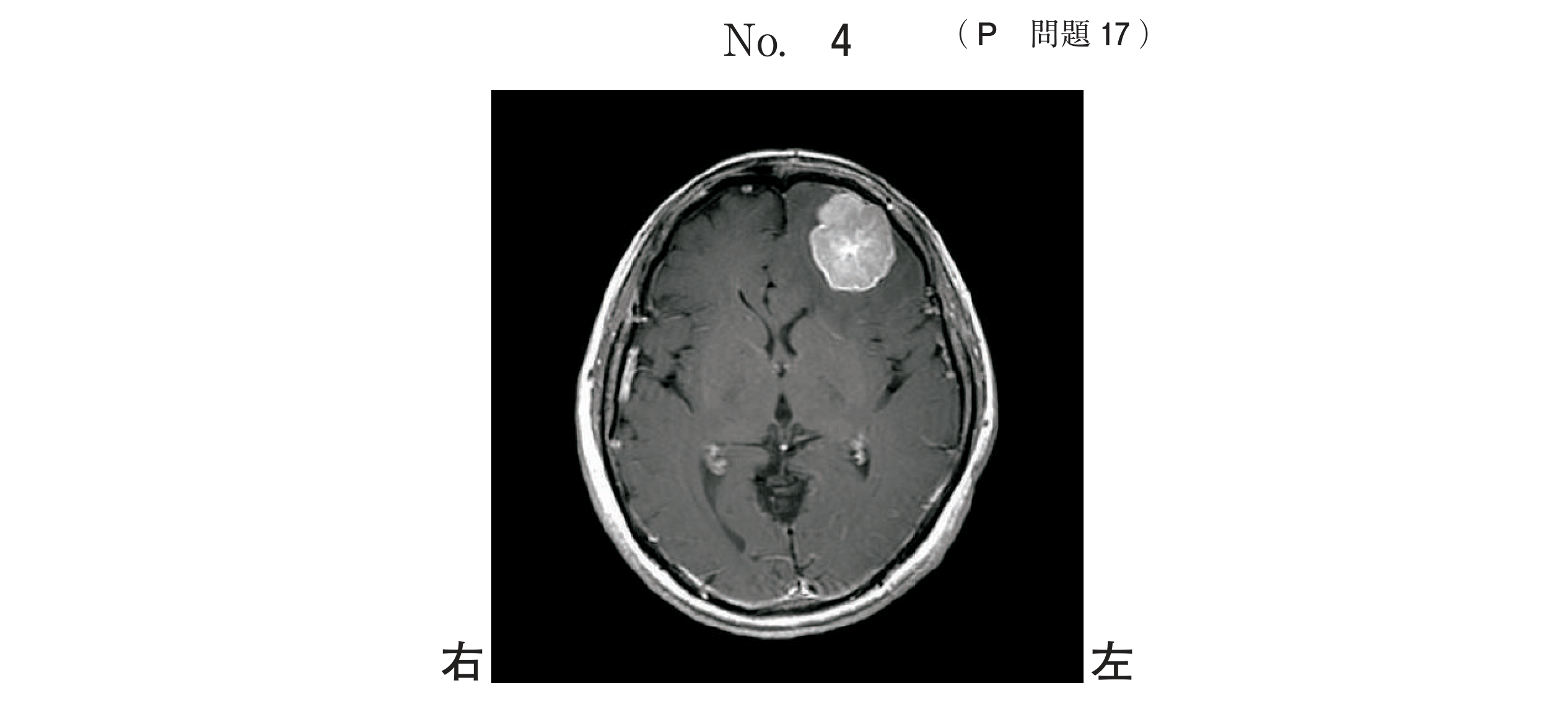 問題画像